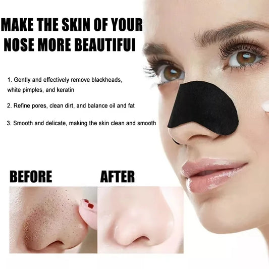 GLAMOORA Blackhead Removal Strips
