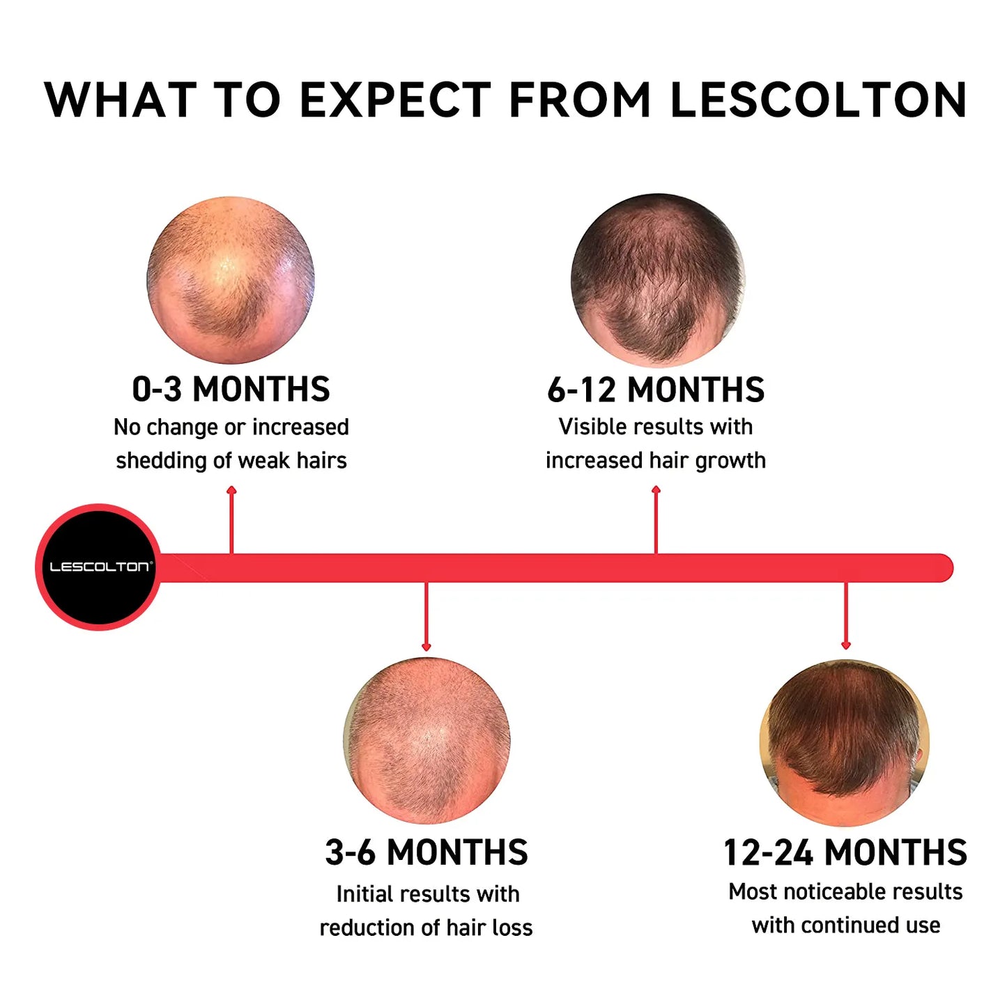 GlowGrow Pro: Regrow Thicker, Fuller Hair!