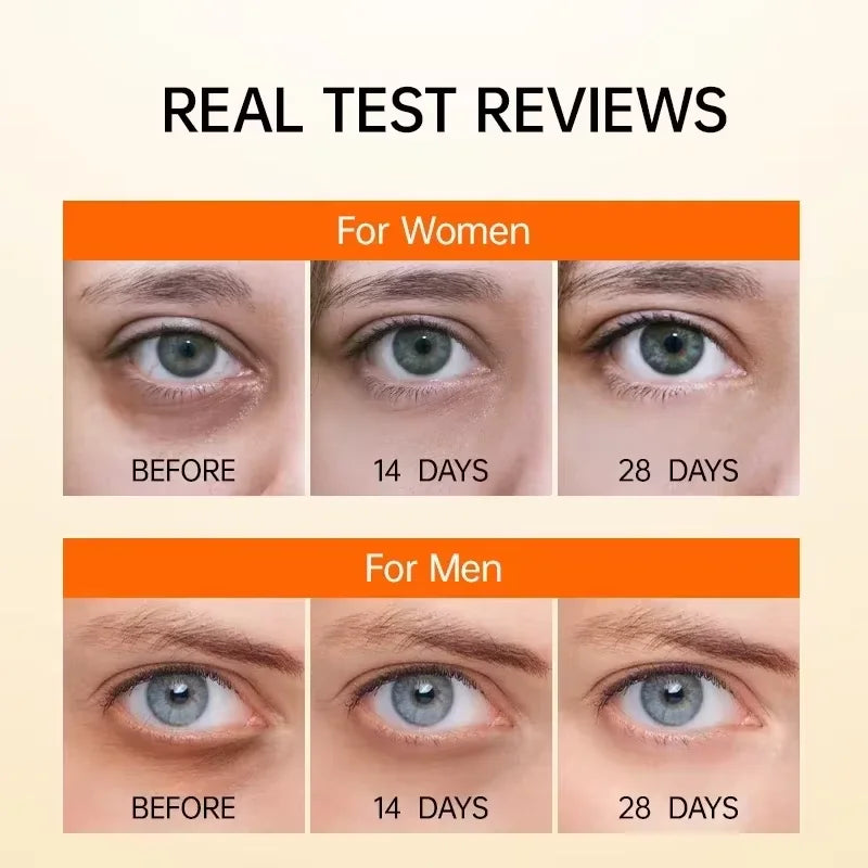 GLAMOORA Retinol Eye Serum