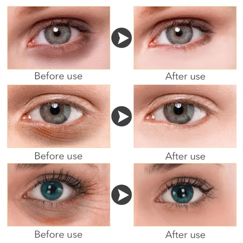 GLAMOORA Retinol Eye Serum